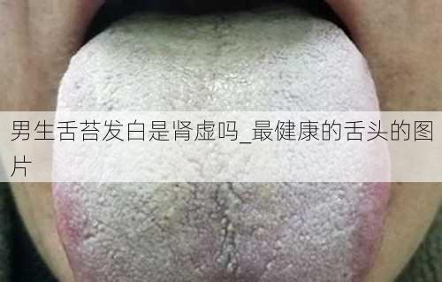 男生舌苔发白是肾虚吗_最健康的舌头的图片